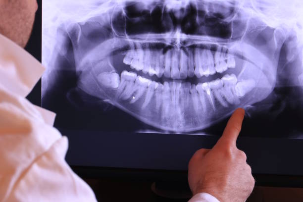 Best Dental Emergency Near Me  in Forest, OH