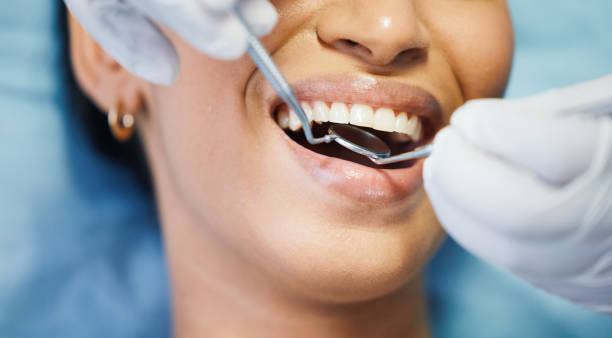 Best Affordable Emergency Dental Care  in Forest, OH